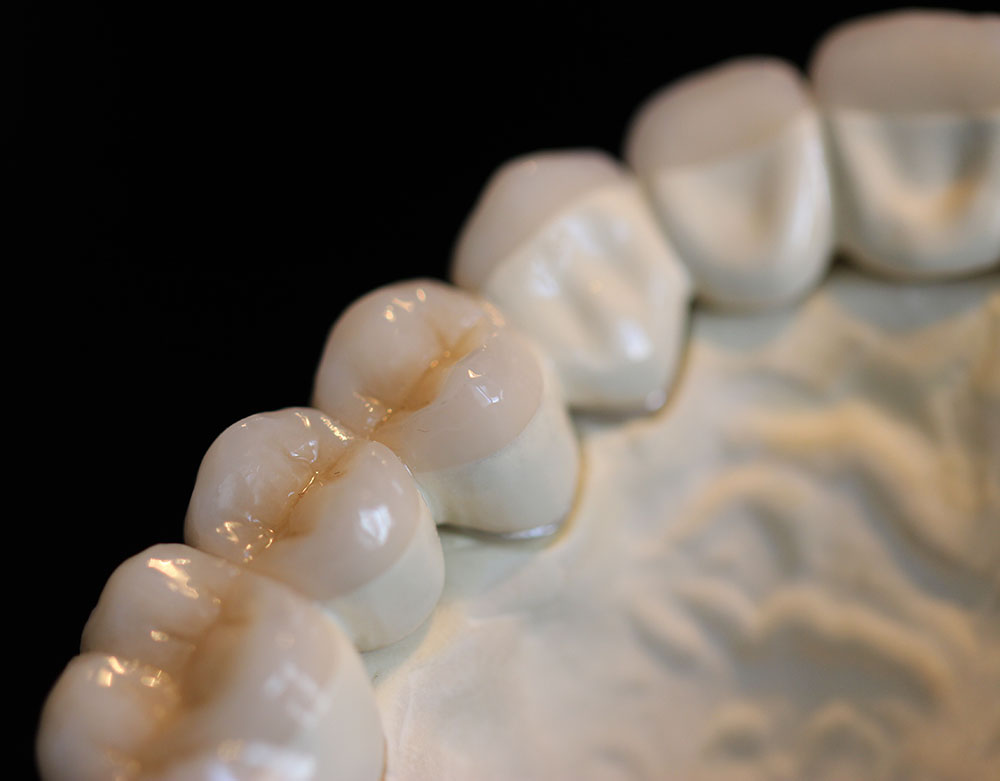 Scherz Dental Ihr Dentallabor für Berlin und Brandenburg